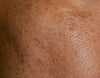 Concern image