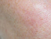 Concern image