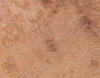Concern image